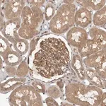 Merck Anti-OSBPL9 antibody produced in rabbit