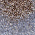Merck Anti-EPHX2 antibody produced in rabbit
