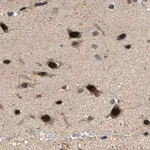 Merck Anti-LARP6 antibody produced in rabbit