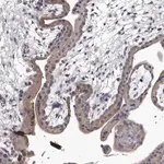 Merck Anti-GAPVD1 antibody produced in rabbit
