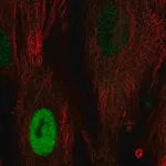 Merck Anti-CCND1 antibody produced in rabbit