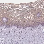 Merck Anti-GSDMC antibody produced in rabbit
