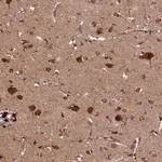 Merck Anti-SLC11A2 antibody produced in rabbit