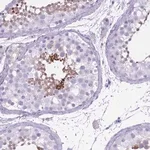 Merck Anti-OR7C1 antibody produced in rabbit