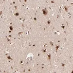Merck Anti-TOP1MT antibody produced in rabbit