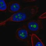 Merck Anti-CDKN2A antibody produced in rabbit