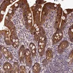 Merck Anti-ABCB8 antibody produced in rabbit