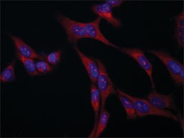 Merck Anti-VAC14 antibody produced in rabbit