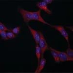 Merck Anti-VAC14 antibody produced in rabbit