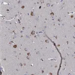 Merck Anti-TMX2 antibody produced in rabbit