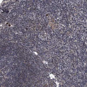 Merck Anti-KBTBD8 antibody produced in rabbit
