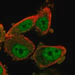 Merck Anti-WT1 antibody produced in rabbit