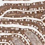 Merck Anti-SLC29A1 antibody produced in rabbit