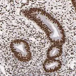 Merck Anti-MRE11 antibody produced in rabbit