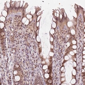 Merck Anti-KAT6A antibody produced in rabbit