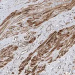Merck Anti-LATS1 antibody produced in rabbit