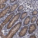 Merck Anti-ERMP1 antibody produced in rabbit