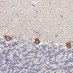Merck Anti-OTUD3 antibody produced in rabbit