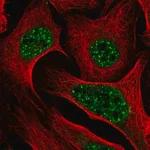 Merck Anti-DLX2 antibody produced in rabbit