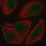 Merck Anti-TOX2 antibody produced in rabbit