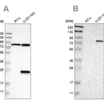 Merck Anti-ALDH18A1 antibody produced in rabbit