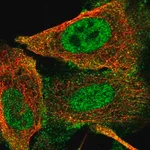 Merck Anti-GLI1 antibody produced in rabbit