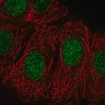 Merck Anti-ZRANB3 antibody produced in rabbit