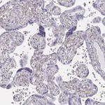 Merck Anti-ENPP1 antibody produced in rabbit