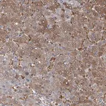 Merck Anti-PFKL antibody produced in rabbit