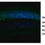 Merck Anti-NRL (Neural Retina Leucine Zipper)