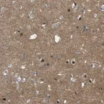 Merck Anti-GPR158 antibody produced in rabbit