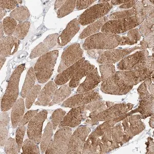 Merck Anti-TONSL antibody produced in rabbit