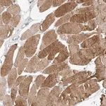 Merck Anti-TONSL antibody produced in rabbit