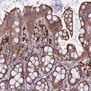 Merck Anti-CARMIL2 antibody produced in rabbit
