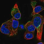 Merck Anti-KISS1R antibody produced in rabbit