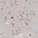 Merck Anti-AGPS antibody produced in rabbit