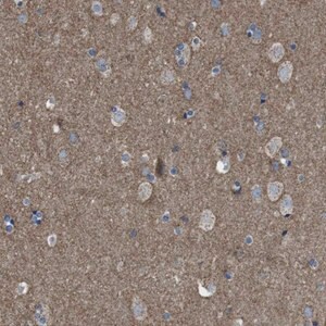 Merck Anti-GRIK2 antibody produced in rabbit