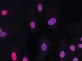 Merck Anti-HMGB2 (HMG2) antibody produced in rabbit