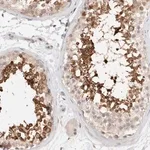 Merck Anti-C17orf97 antibody produced in rabbit