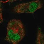 Merck Anti-T antibody produced in rabbit