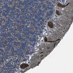 Merck Anti-GRAMD1A antibody produced in rabbit