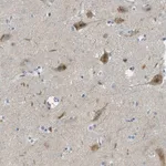 Merck Anti-SNX14 antibody produced in rabbit