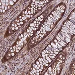 Merck Anti-COMMD2 antibody produced in rabbit