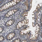 Merck Anti-SAMD4B antibody produced in rabbit