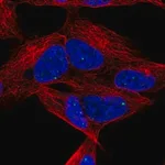 Merck Anti-DLX6 antibody produced in rabbit