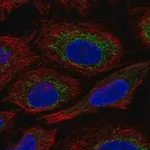 Merck Anti-C7orf73 antibody produced in rabbit