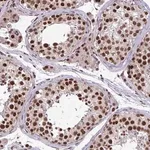 Merck Anti-TTF1 antibody produced in rabbit