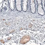 Merck Anti-CXCL8 antibody produced in rabbit