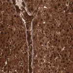 Merck Anti-FTSJ1 antibody produced in rabbit