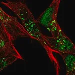 Merck Anti-SLC16A6 antibody produced in rabbit